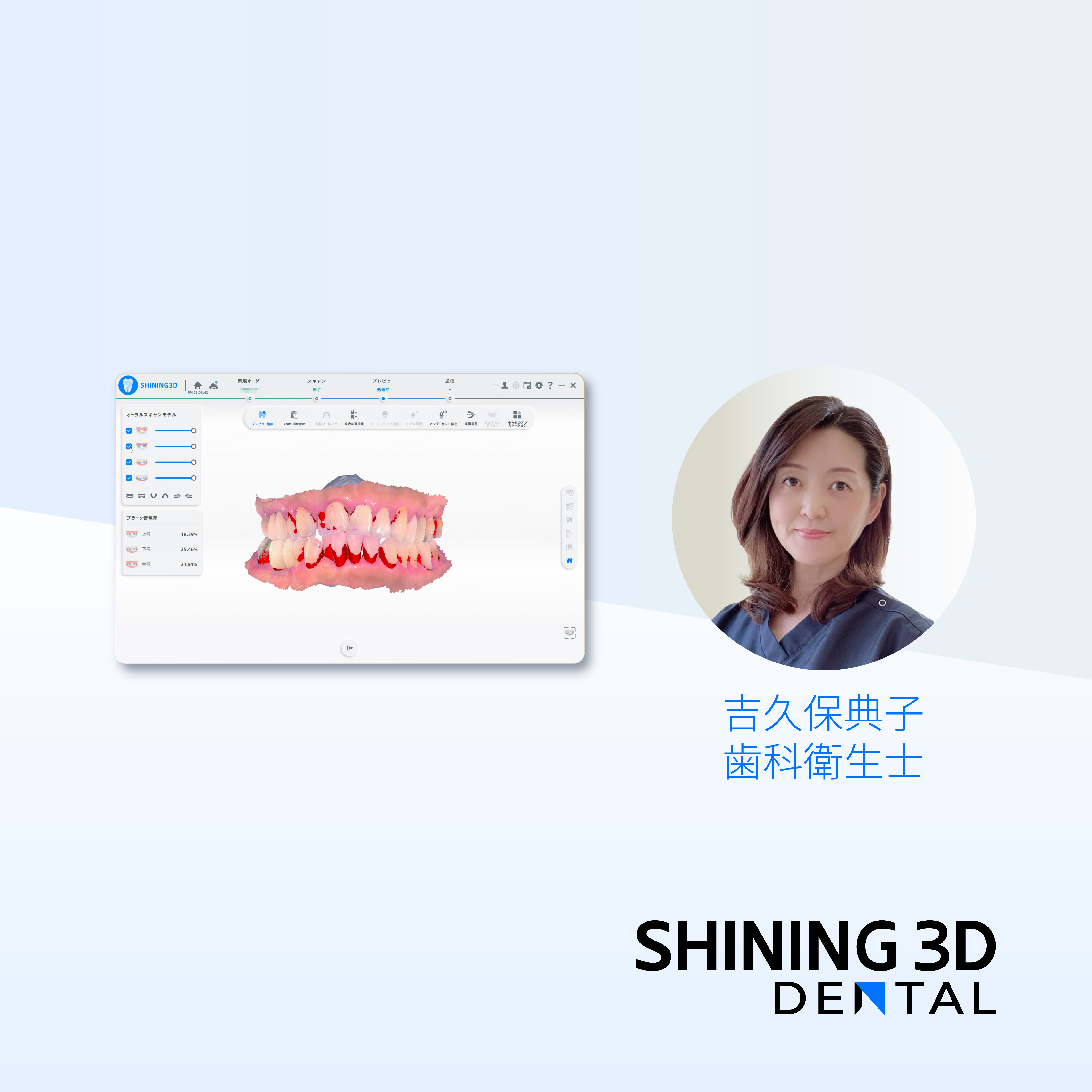 “ 見える化 ” から “ 測定可能な客観的評価 ” へAoralscan プラーク検知機能の臨床活用