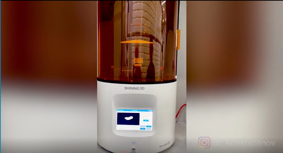 full-guided-implant4