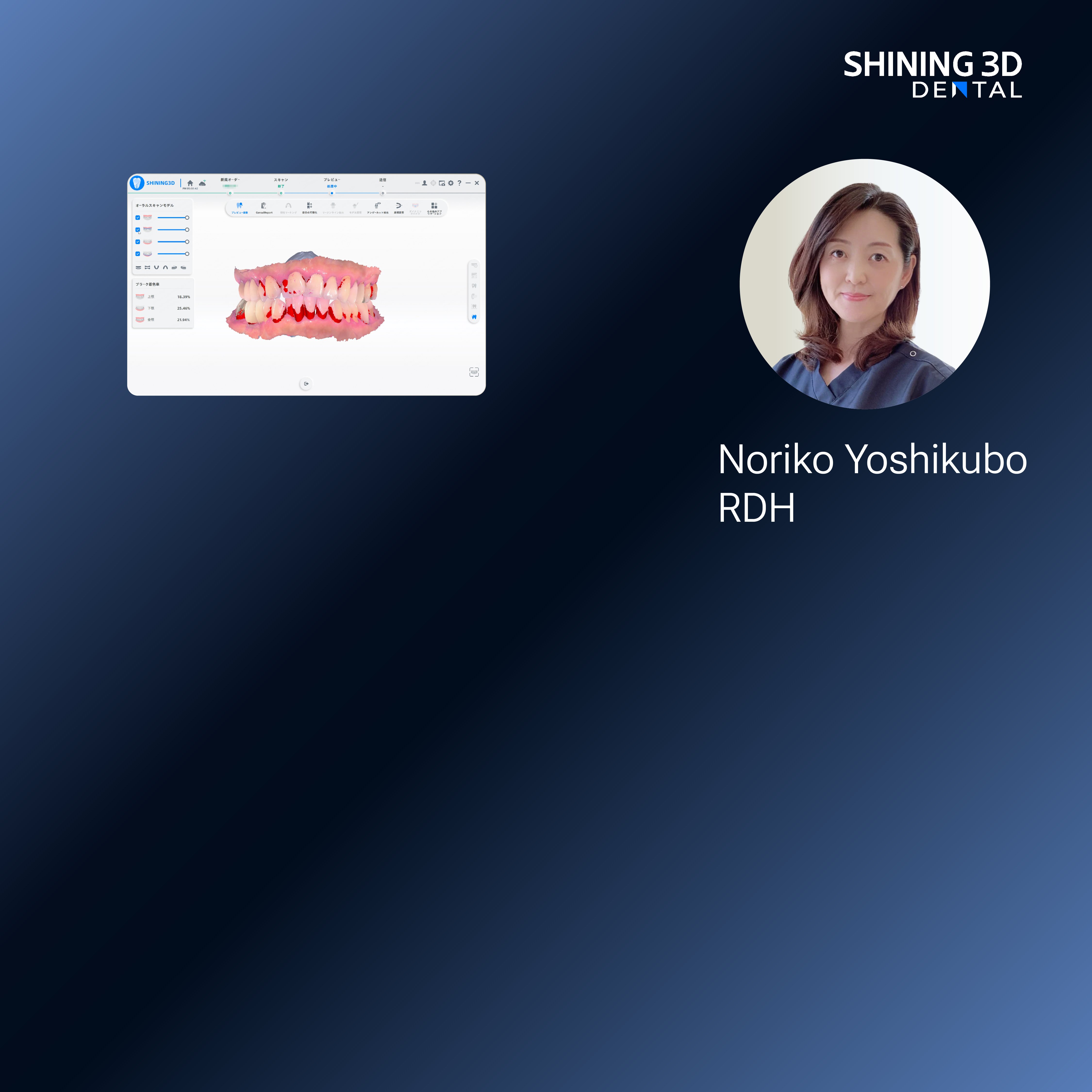 shining 3d dental